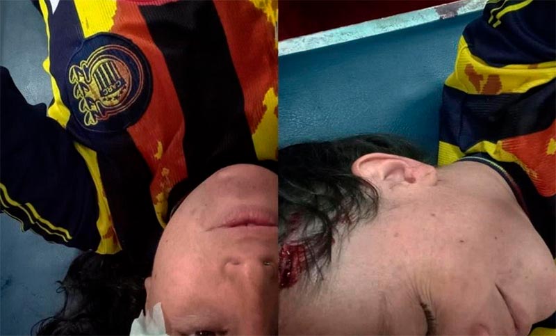 Hincha de Central atacada con ladrillo en Rosario: «Me tiró a matar»