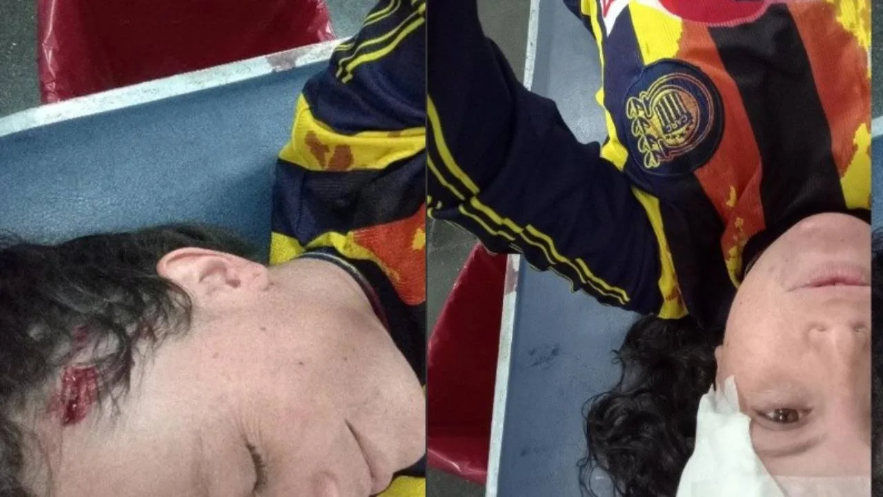 Hincha de Central atacada a piedrazos en Rosario: «La saqué barata»